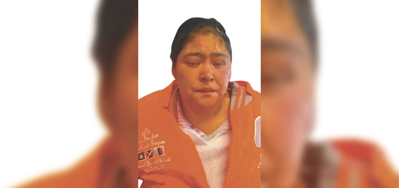 Ataca con cuchillo a mujer en Jiutepec