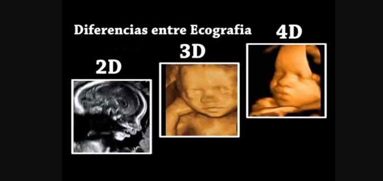 Ecografía 4D: tu bebé en movimiento