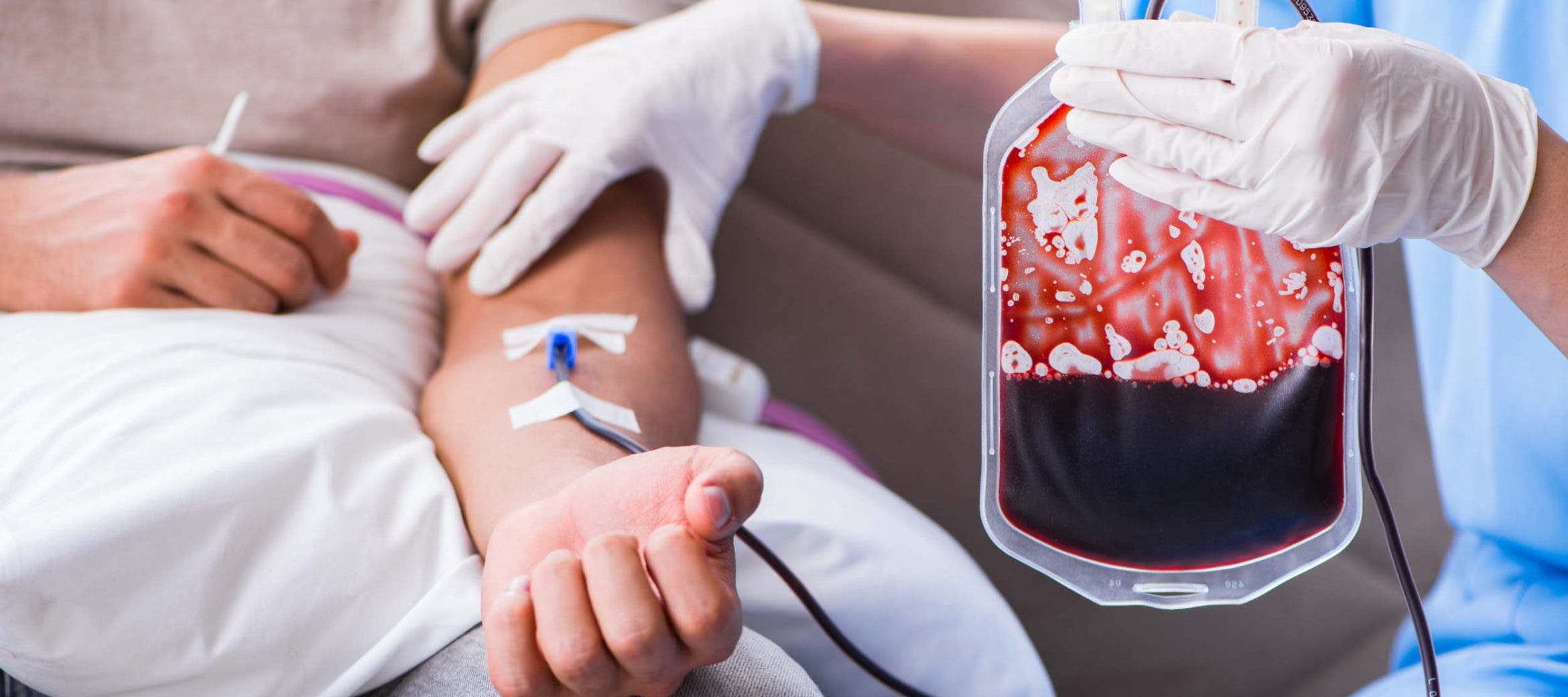 Синдром донора. Переливание донорской крови. Переливание крови донорство.
