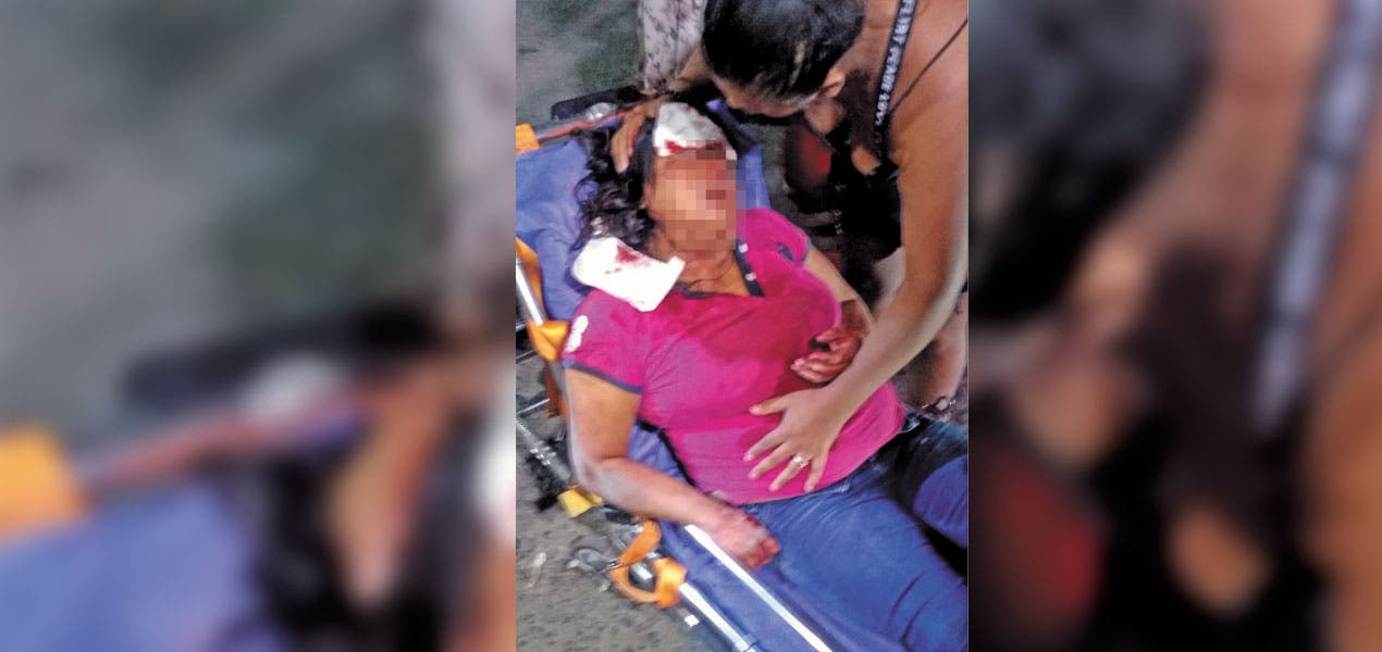 Recibe pareja severa golpiza en Cuautla Morelos