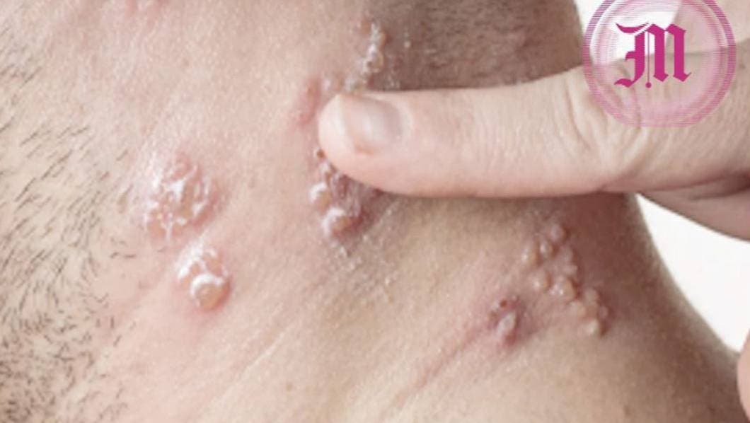 ¿CONOCES LA FAMOSA CULEBRILLA? ...