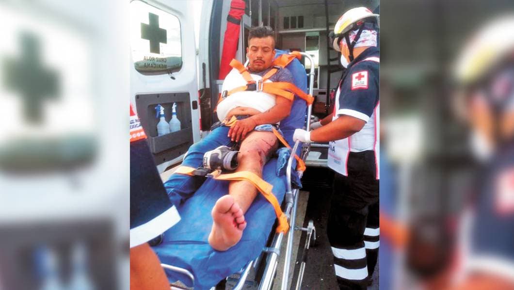 En Morelos, derrapa y termina fracturado