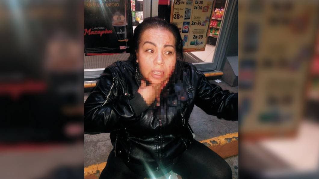 Apuñala a su esposa en Av. Río Mayo, de Cuernavaca