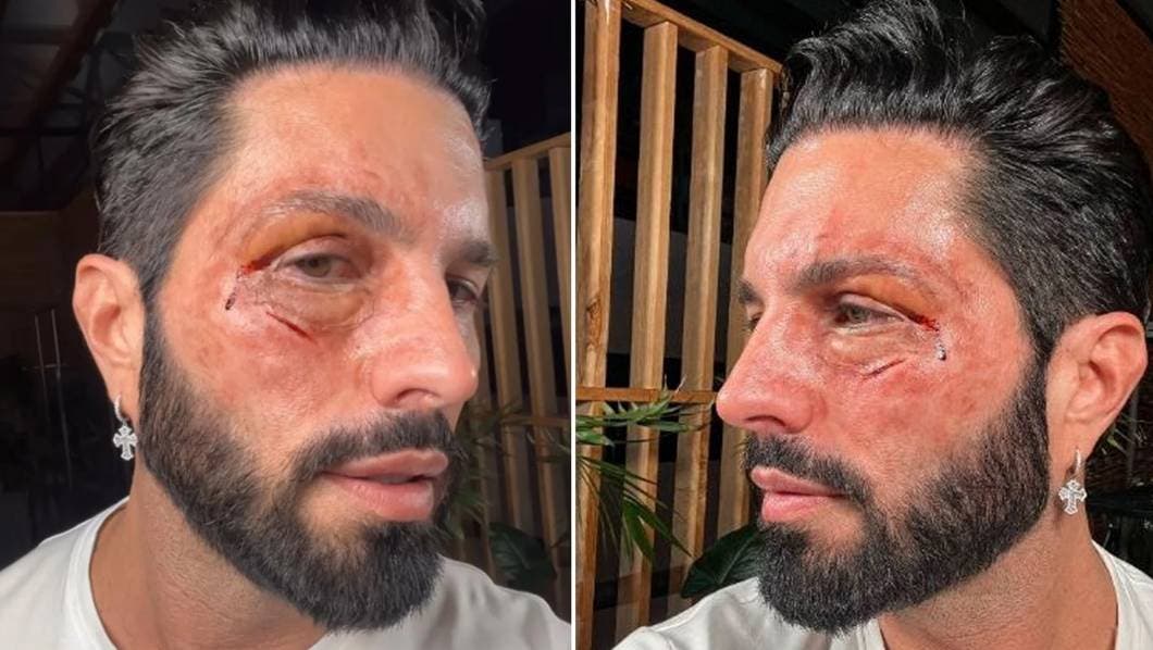 VIDEO: ¿Qué sucedió con Poncho de Nigris que apareció golpeado en redes? 