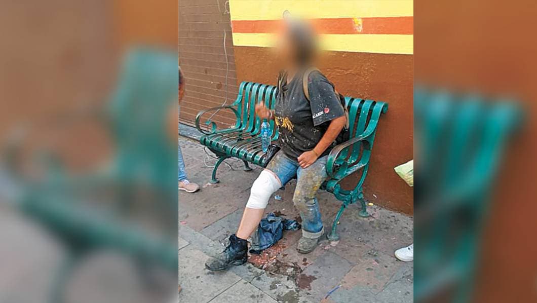 Cae en alcantarilla y se lesiona en Morelos