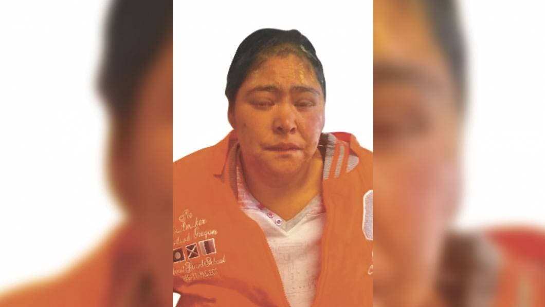 Ataca con cuchillo a mujer en Jiutepec