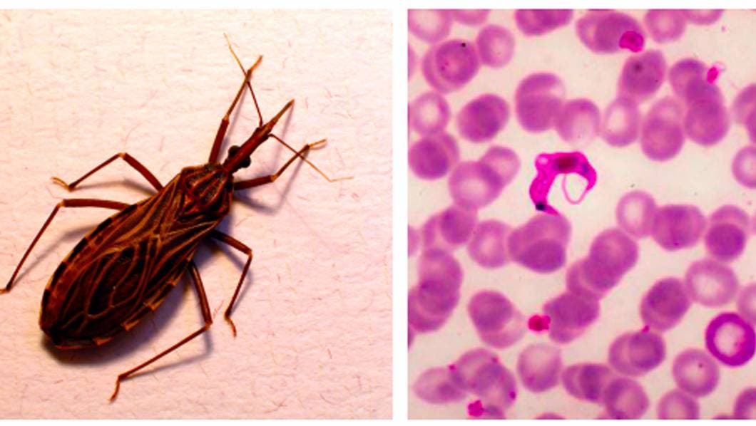 La enfermedad de Chagas es causada por el parásito Trypanosoma cruzi