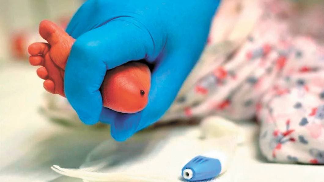 Tamiz Auditivo Neonatal