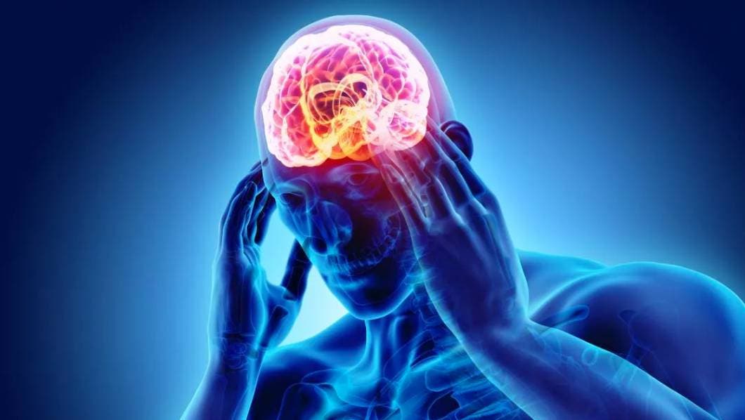 ¿Tienes dolor de cabeza y lo atribuyes a la migraña? Podrías sufrir un Aneurisma,  aquí te explicamos la diferencia 