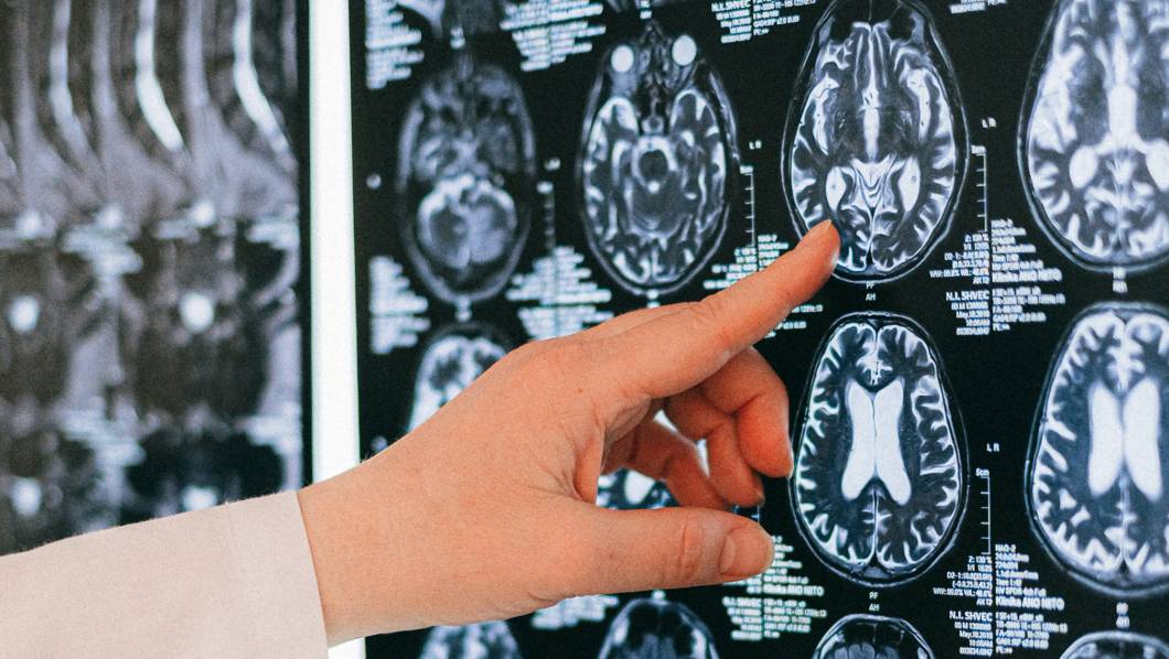 “Yo decido”, en el Día Mundial de Parálisis Cerebral