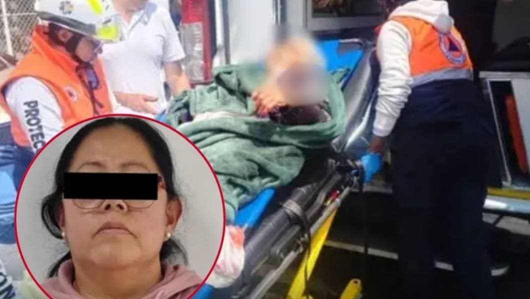 perro muerde a anciana