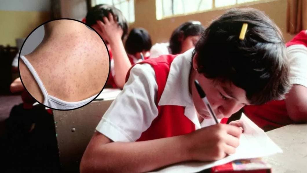 Brote de sarampión en México: estados exigen cartilla de vacunación para reinscribirse en la escuela