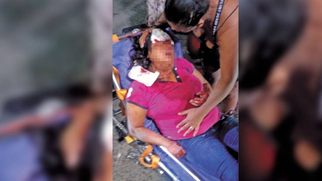 Recibe pareja severa golpiza en Cuautla Morelos