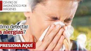 ¿Cómo detectar las alergias?  2