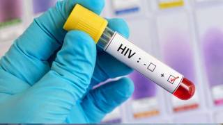 Casos de VIH Aumentan en México: Seis Estados Concentran May...