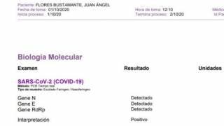 Da positivo a COVID-19 alcalde de Jojutla Juan Ángel Flores...