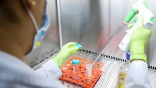 Anuncia Rusia con éxito prueba en humanos de vacuna vs COVID...