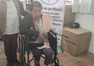 Mejo­ran pró­te­sis cali­dad de vida en Tépoz