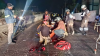 La imágen contiene: Motociclista sufre grave fractura tras accidente en Cuautla Motociclista sufre grave fractura tras accidente en Cuautla