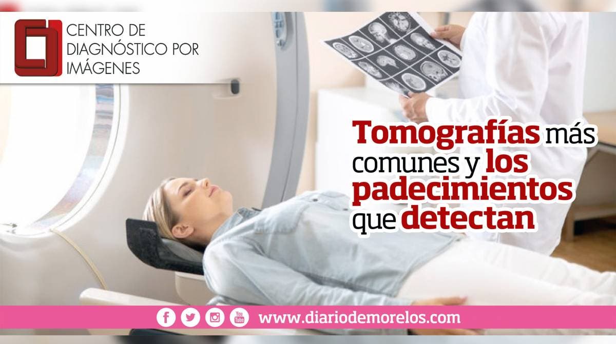 CDI - Tomografia