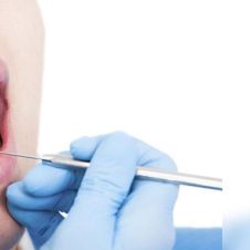 caries-prevencion-dientes-020119.jpg