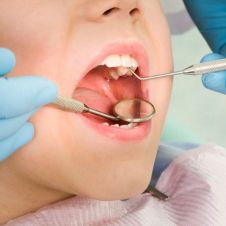 Médicos sacan aguja de dentista del cerebro de una niña de 4 años