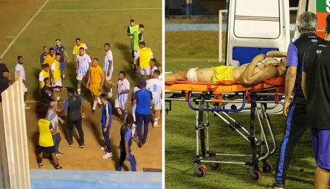 VIDEO: Policía le dispara a futbolista en la pierna tras final de partido 