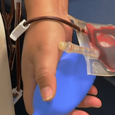 Le dieron 3 meses de vida pero logró vencer al cáncer gracias a la inmunoterapia.png