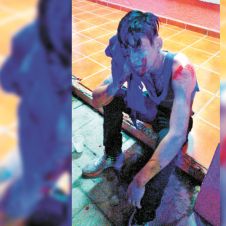 herido-carolina_levantaddos-030922.jpg