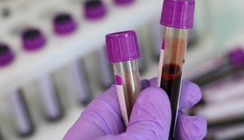 Te compartimos la lista de laboratorios donde te pueden hacer la prueba del Covid-19.jpg