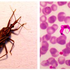 La enfermedad de Chagas es causada por el parásito Trypanosoma cruzi 