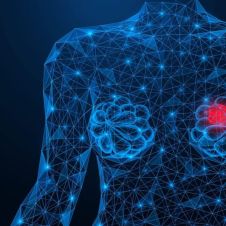 IA cancer de mama.jpg