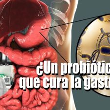 probiotico-gastritis.jpg