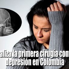 Cirugía-contra-la-depresión.jpg