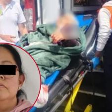 perro muerde a anciana