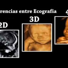 Ecografía 4D: tu bebé en movimiento