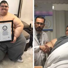3950_obesidad.JPG