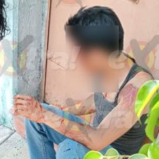 Joven derrapa en motocicleta en Cuautla
