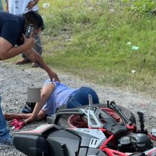 Joven de 24 años resulta con el rostro desfigurado en Veracruz Joven de 24 años resulta con el rostro desfigurado en Veracruz