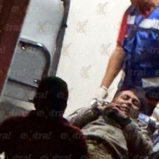 Choque deja un lesionado de gravedad en Yautepec