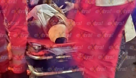 Atropellan a un hombre en la Cuernavaca-Cuautla
