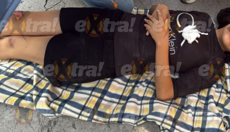 Accidente en Miacatlán: Joven derrapa en moto en La Campesina