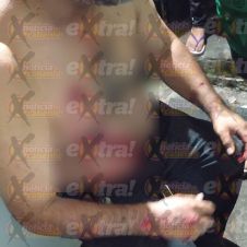 Lesionado en Cuautla Lesionado en Cuautla