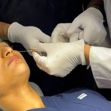 Prohíben en Morelos cirugías reconstructivas para menores