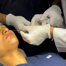 Prohíben cirugías estéticas a menores en Morelos con la Ley Nicole