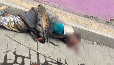 Auxilian a hombre en situación de calle tras caída en Jumiltepec