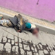 Auxilian a hombre en situación de calle tras caída en Jumiltepec