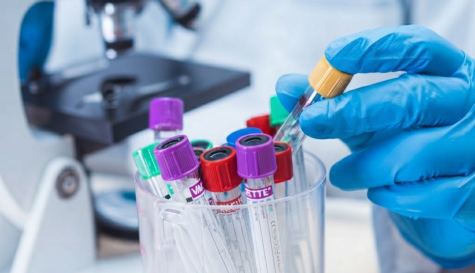 Muere investigadora rusa de laboratorio de peste y genera alerta