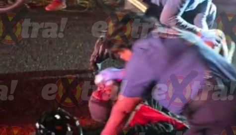 Cicilista atropellado en Yecapixtla