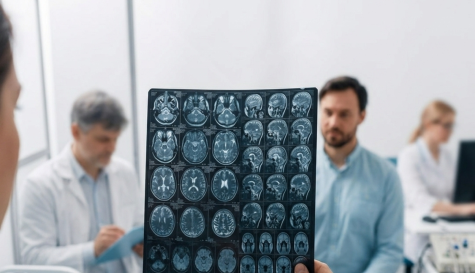 Cambio climático: cómo el calor aumenta los riesgos para el cerebro